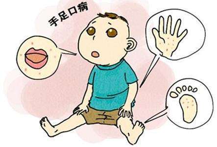 春意盎然，勿忘防治手足口